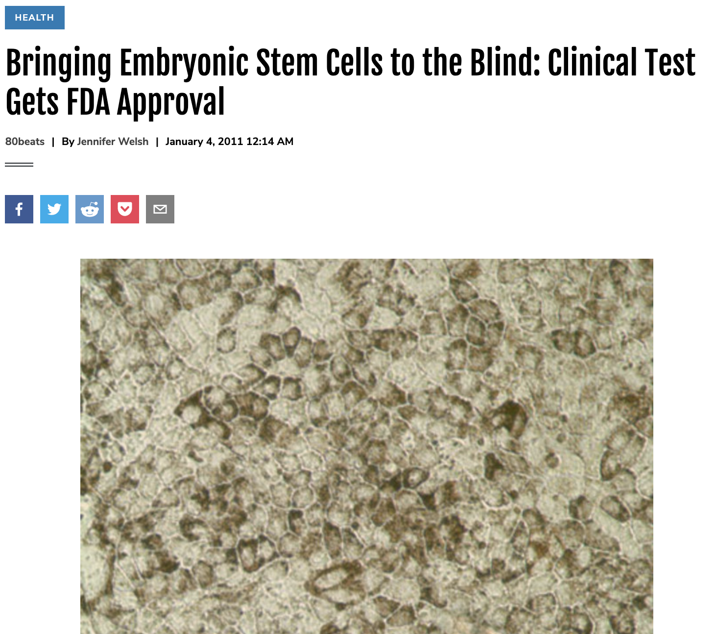 Bringing Embryonic Stem Cells to the Blind: Clinical Test Gets FDA Approval